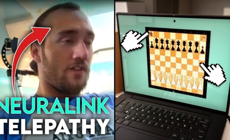  NEURALINK: Pacienti i parë me çip të implantuar në tru luan shah vetëm përmes mendimit të tij (VIDEO)